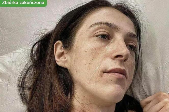 Почти 9,3 миллиона злотых – не рекордный лотерейный выигрыш. Столько поляки заплатили за спасение Ивоны