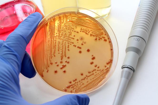 Escherichia coli - тестируется новый препарат в борьбе с бактериями типа EHEC