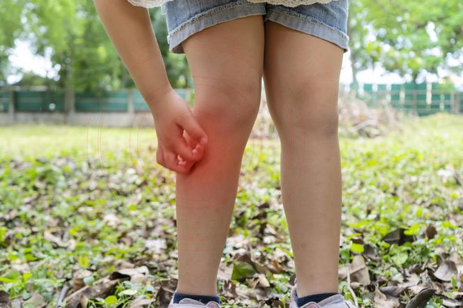 «Меня только комары кусали, а теперь у меня болезнь Лайма». Является ли это возможным?