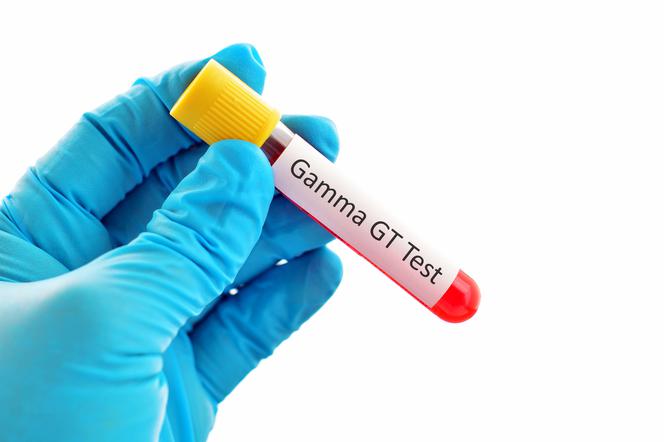 ГГТП: что это такое? Исследование GGTP: нормы и интерпретация результатов