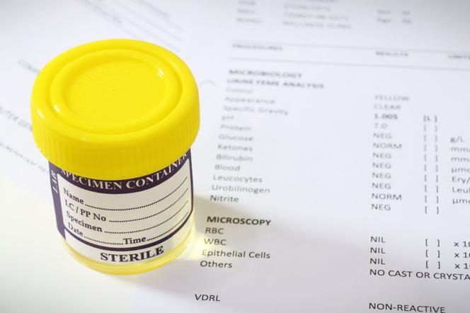 Ureaplasma urealyticum – возбудитель инфекции МОЧЕВЫХ путей