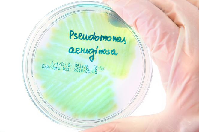 Pseudomonas aeruginosa – что это такое? Какие заболевания вызывает Pseudomonas aeruginosa?