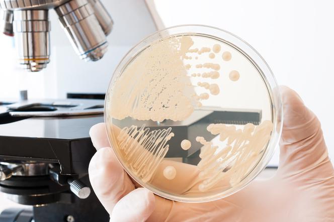 Candida albicans (дрожжевой грибок, вызывающий микоз) - симптомы, лечение